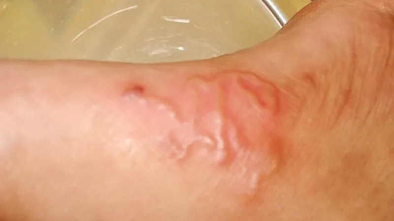 Sán Chó Mèo Có Lây Không: Hiểu Rõ Đường Lây Truyền và Cách Phòng Ngừa Hiệu Quả