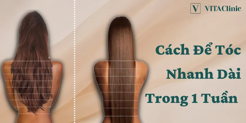 Cách Nuôi Tóc Nhanh Dài Cho Nam Tại Nhà Hiệu Quả