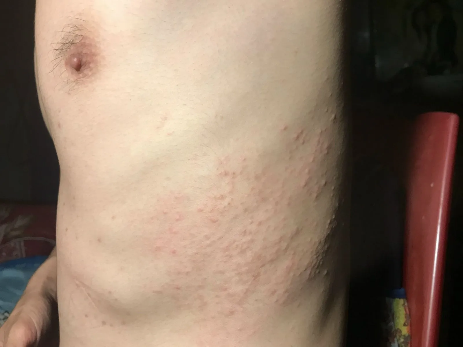 Triệu Chứng Nhiễm Giun Sán Ở Chó: Dấu Hiệu Nhận Biết Và Cách Xử Lý