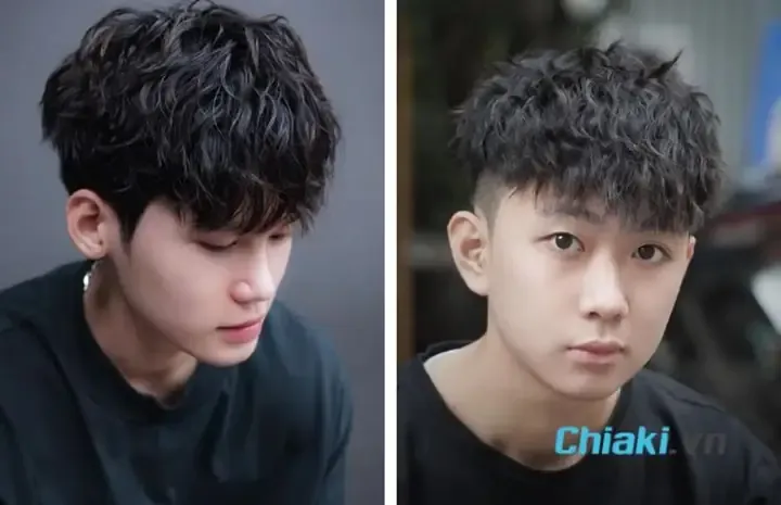 Tình trạng uốn cong xương do thiếu khoáng chất nghiêm trọng